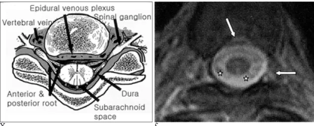 Fig. 1. Normal anatomy of the vertebral canal. 
