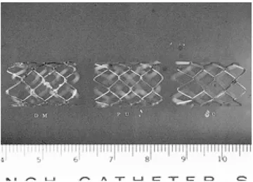 Fig. 1. Three stent types used. There are a NC-, a PU-, and a DM stent (from left to right)