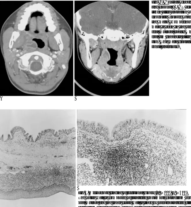 Fig. 3. Microscopic finding of excisional biopsy (a: ×100, b: ×400)