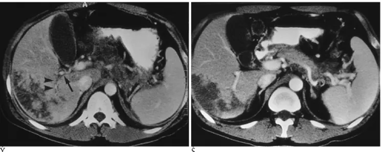 Fig. 3. Follow-up CT scans.