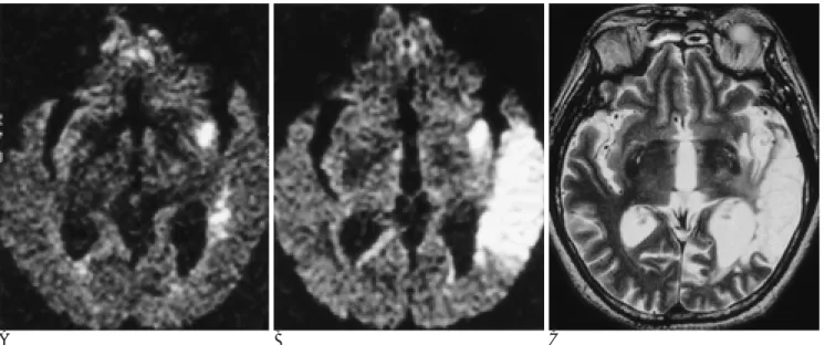 Fig. 1. A 67-year-old man with right hemiplegia and dysarthria. 