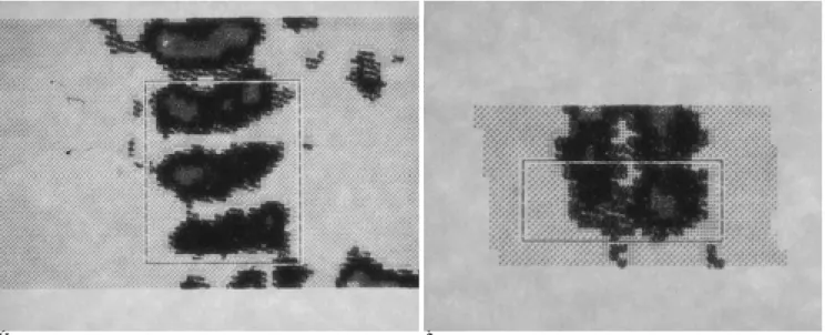 Fig. 1. Representative scan image of lumbar spine (A) and wrist (B) in preterm infant
