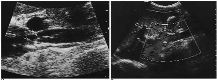 Fig. 2. 2-year-follow up, in same patient with the Fig. 1.