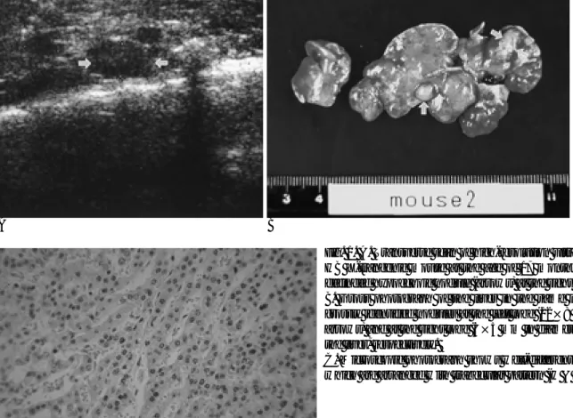 Fig. 1. A. Transverse scan of high-resolution ultrasonogram in the HB X-trangenic mouse at the age of 17 months shows an  well-definded hypoechoic nodule (arrows) at the right lobe of the liver