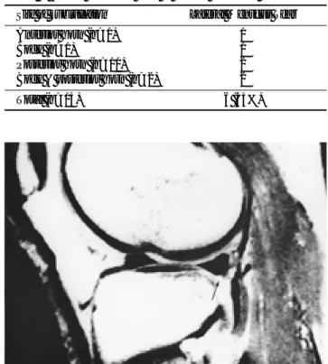 Table 4. Predisposing Factor of Lateral Meniscus Subluxation LM Subluxation Predisposing Factor Cases