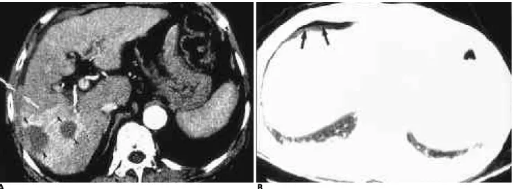 Fig. 3. Two patients with minor complication. 