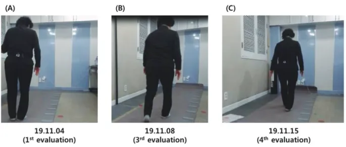 Fig. 1. Change of gait posture according to symptom improved.