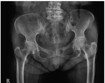 Fig. 1. Pelvic X-ray(2018.08.13.).