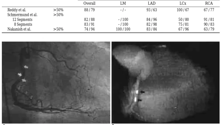 Fig. 5. Stenosis at the bifurcation site.