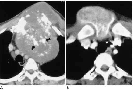 Fig. 1. Primary sternal tumors.