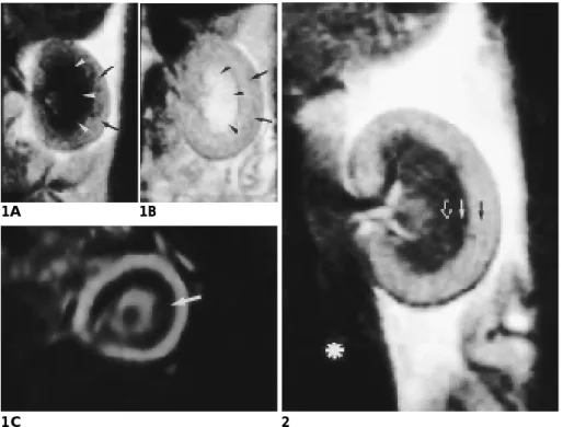 Fig. 1. Normal renal MRI of the rabbit.