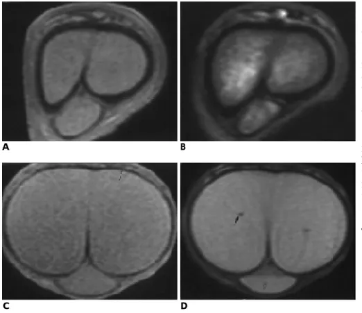 Fig. 1. Coronal MR images of a normal penis in a 32-year-old man.
