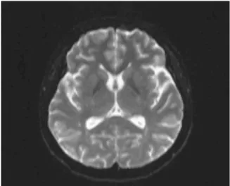 Fig. 1. Brain MRI on 2.27.