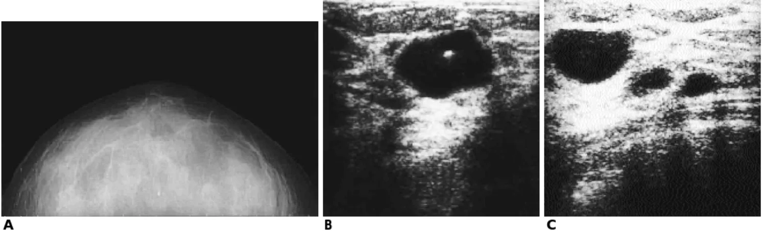 Fig. 2. Pathologic findings of the same lesion with Fig. 1