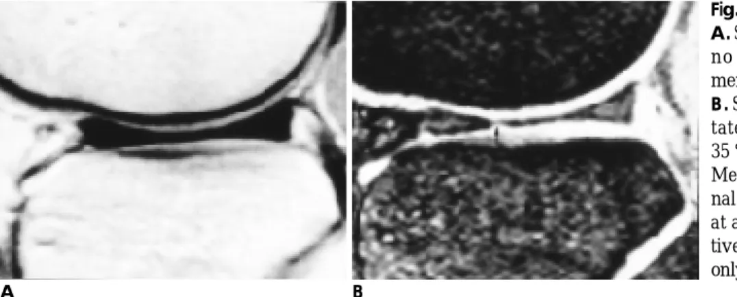 Fig. 4. False negative case(M/35).