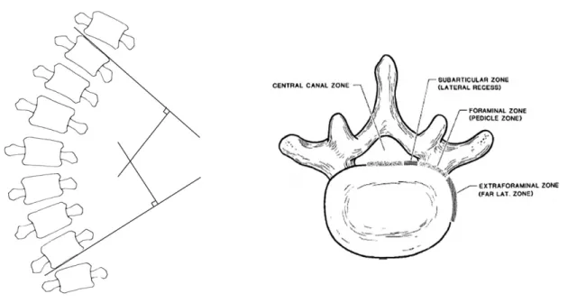 Fig. 1. Measurement of Cobb’ s angle Fig. 2. HIVD of L-spine(Horizontal View)