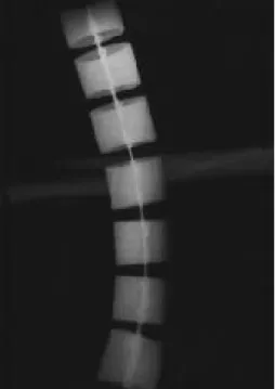 Fig. 1. Photograph of the spine phantom. This structure was constructed using copper pipe and wire