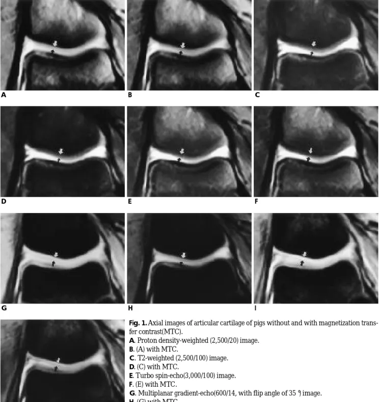 Fig. 1. Axial images of articular cartilage of pigs without and with magnetization trans- trans-fer contrast(MTC).