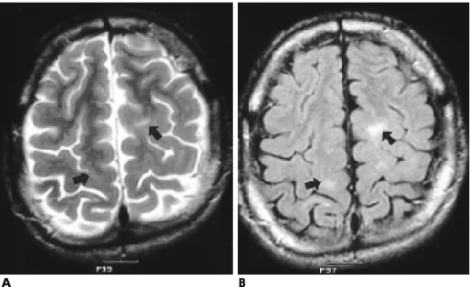 Fig. 1. A 17-year-old boy with visual and motor symptoms.