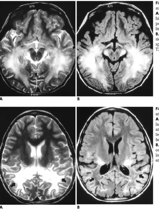 Fig. 3. A 9-year-old boy with visual and auditory symptoms.
