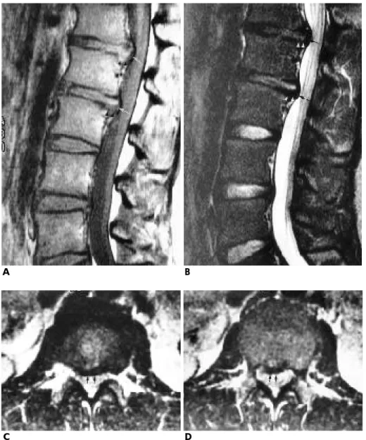 Fig. 3. 27-year-old female with atypi- atypi-cal lower back pain.