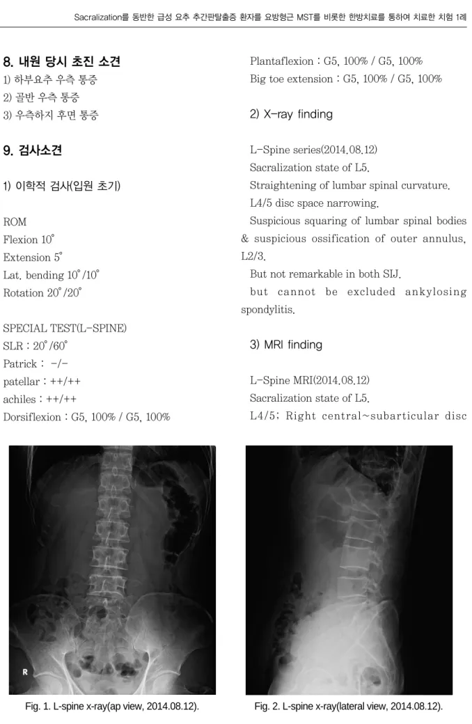 Fig. 1. L-spine x-ray(ap view, 2014.08.12). Fig. 2. L-spine x-ray(lateral view, 2014.08.12).