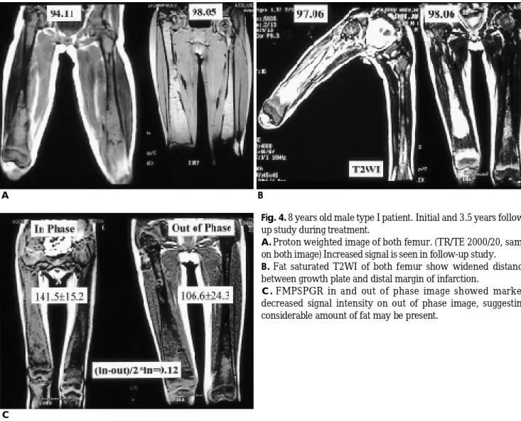 Fig. 4. 8 years old male type I patient. Initial and 3.5 years follow- follow-up study during treatment.