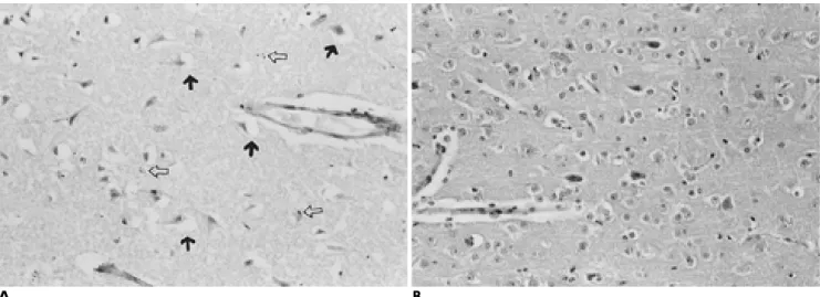Fig. 6. Microphotographic (A) and electron microscopic (B) findings at 31 days. 