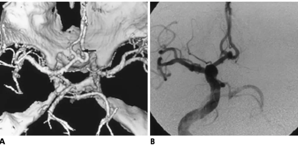 Table 1.Angiographic Findings
