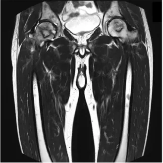Fig. 3. Leg MRI T2(2012.06.25.).