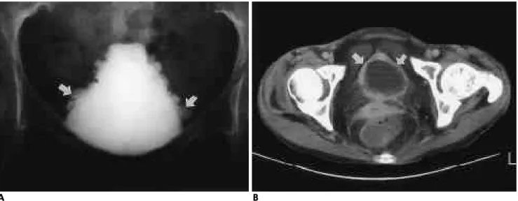 Fig. 15. Interstitial cystitis. 