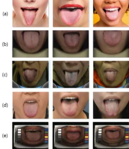 Fig.  10.  Tongue  Images  of  BioHit