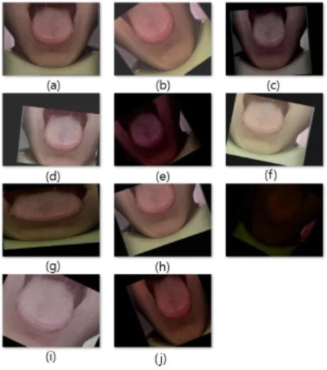 Fig.  12.  Examples  of  Data  Augmentation