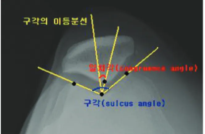 Fig. 1.  Congruence Angle.