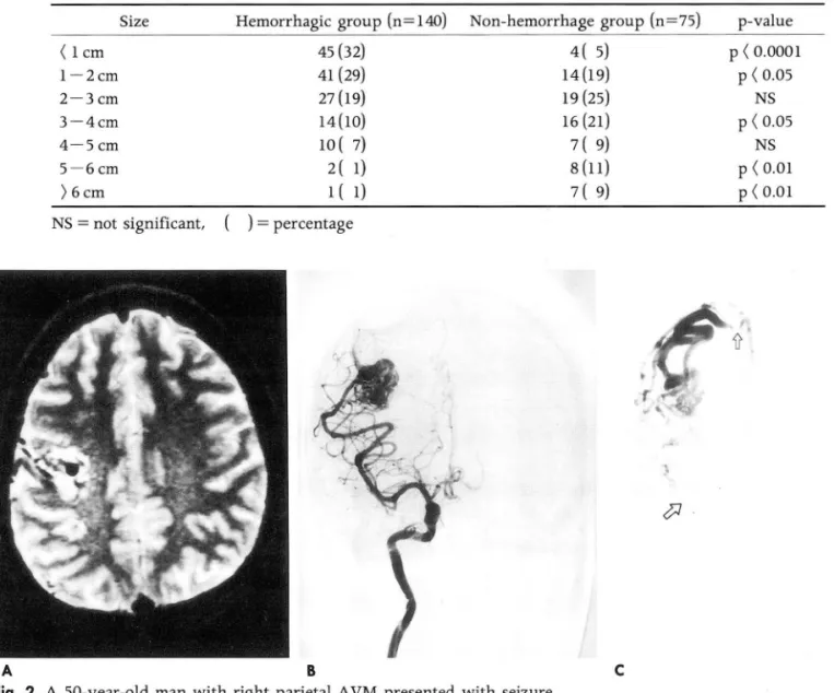 Fig.  2.  A  50-year-old  man  with  right  parietal  AVM  presented  with  seizure. 
