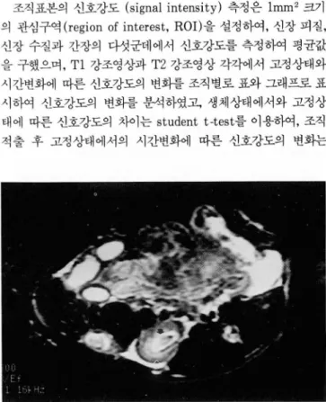 Fig.  2.  Signal  intensity  of  renal  cortex(open  arrow)  and  medula(arrow)  of  rabbit  in  vivo  state  was  measured  on  T2WI  after  pentotal sodium  i띠ection  on  IV  route