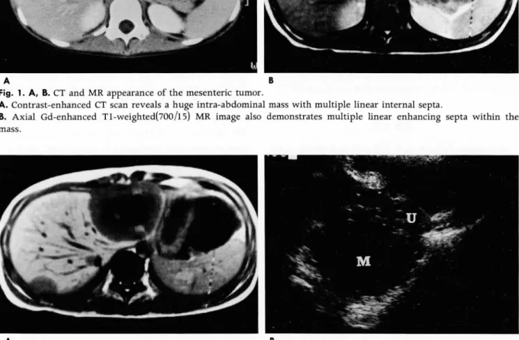 Fig.  2.  A ,  B.  Radiological  imagings  of the  other  intraperitoneal  organs. 