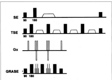 Fig.  1.  Schematic  diagram  of differences  between  conven- conven-tional  spin-echo ,  turbo  spin-echo ,  and  GRASE  (gradient  echo-EPI  and  turbo  spin-echo)  images