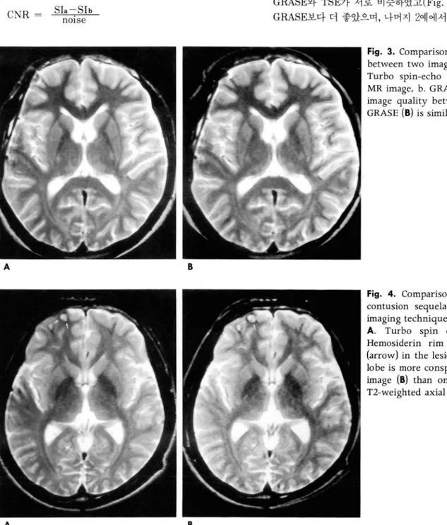 Fig.  3.  Comparison  of image  quality  between  two  imaging  techniques.  a. 