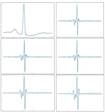 Fig.  5.  ECG  Signals  According  to  Filtering  Sequence 필터링 단계  진행에  따른  심전도  신호의  형태는 Fig