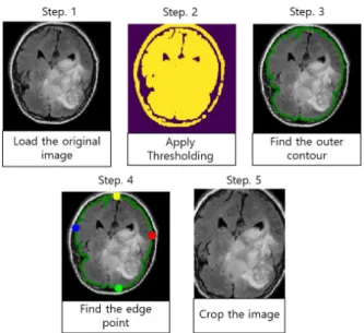 Fig.  2.  Brain  MRI  image  pre-processing