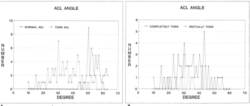 Fig.  3.  A.  Frequency  distribution  of ACL  angle  between  patients  with  a  normal  ACL  and  patients  with  a  torn  ACL  shows  good  separation