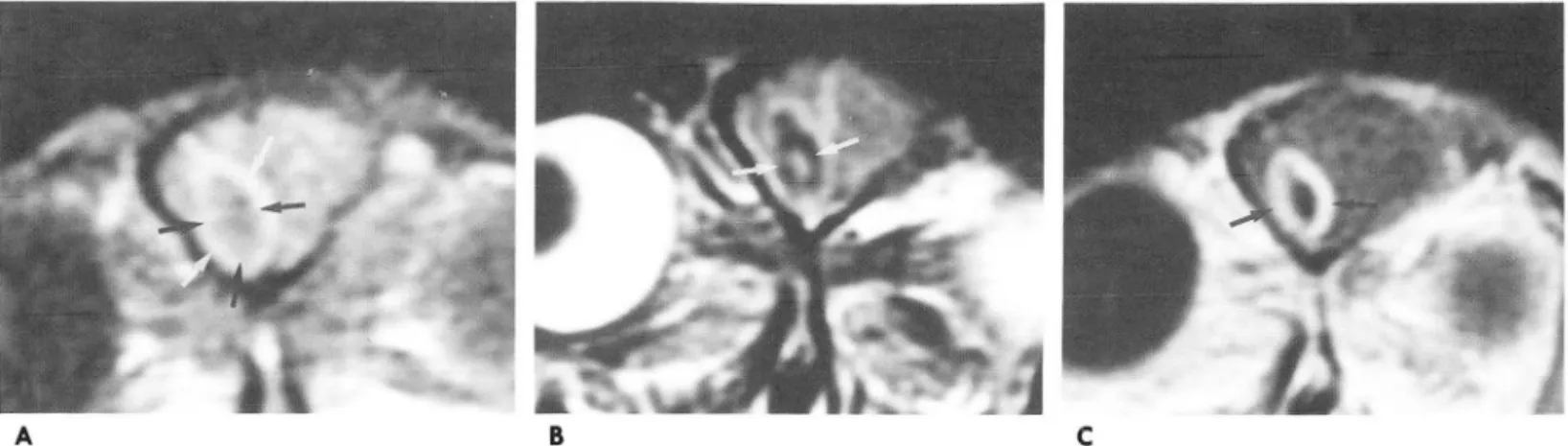 Fig.  4.  Late  caps ular stage  of brain  abscess in  rabbit 