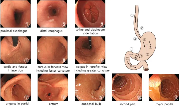 Fig.  3.  Example  Images  to  be  removed  from  Classification