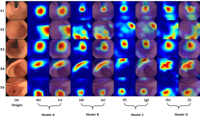 Fig.  6.  Grad  CAM Layer를  가지고  있을  때,  학습한  모델을  변경  없이  히트  맵을  그릴  수  있게  하는  Grad-CAM[22]을  사용하였다