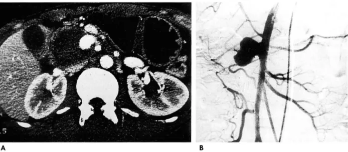 Fig.  s.  Patient  11 