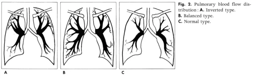 Fig.  2.  Pulmorary  blood  f1 0w  dis- dis-tribution : A.  Inverted  type  B.  Balanced  type