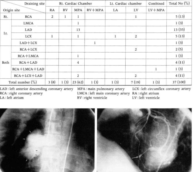 Table  1.  Classification  of Coronary  Artery Fistula  by Origin  and  Draining  Site 