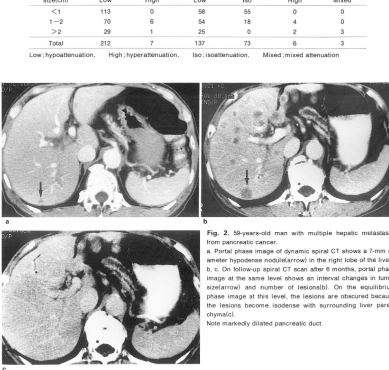 Table  1.  Correlation  between  Tumor  Size  and  Enhancement  Pattern  on  Two-phase  Dynamic  Spiral  CT  in  44  Patients with  Li ver  Metastases(n  =  219) 