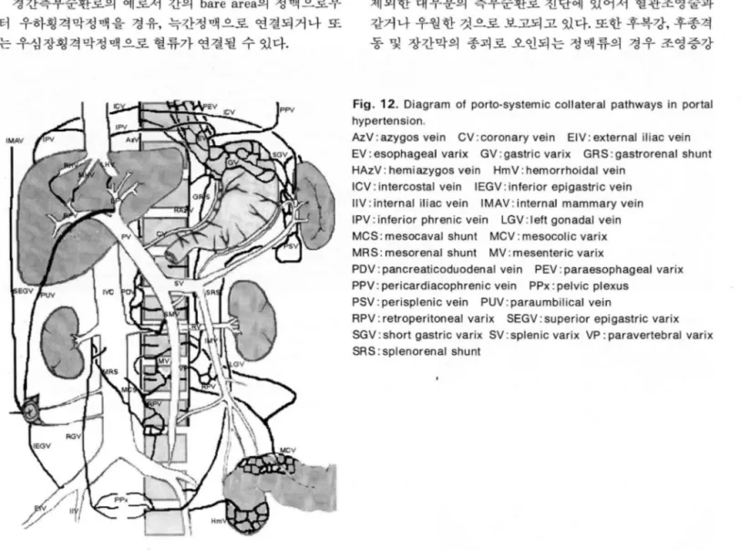 Fig .  12.  Diagram  01  porto-systemic  collateral  pathways  in  portal  hypertension 